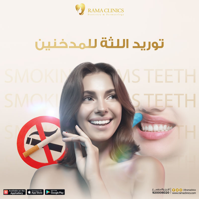 توريد اللثة للمدخنين في عيادات راما