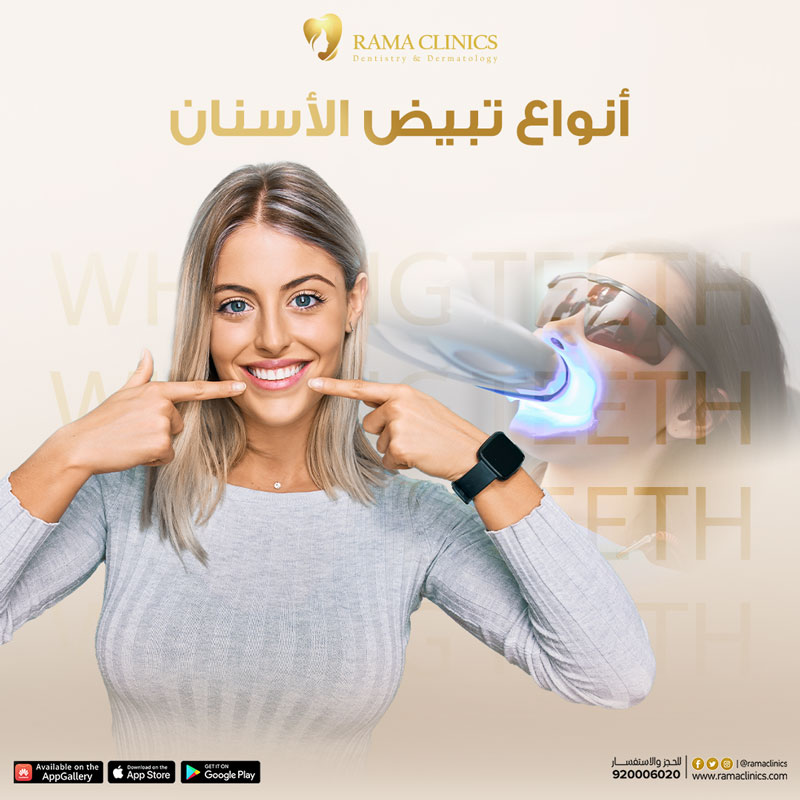 ما أفضل أنواع تبييض الأسنان؟